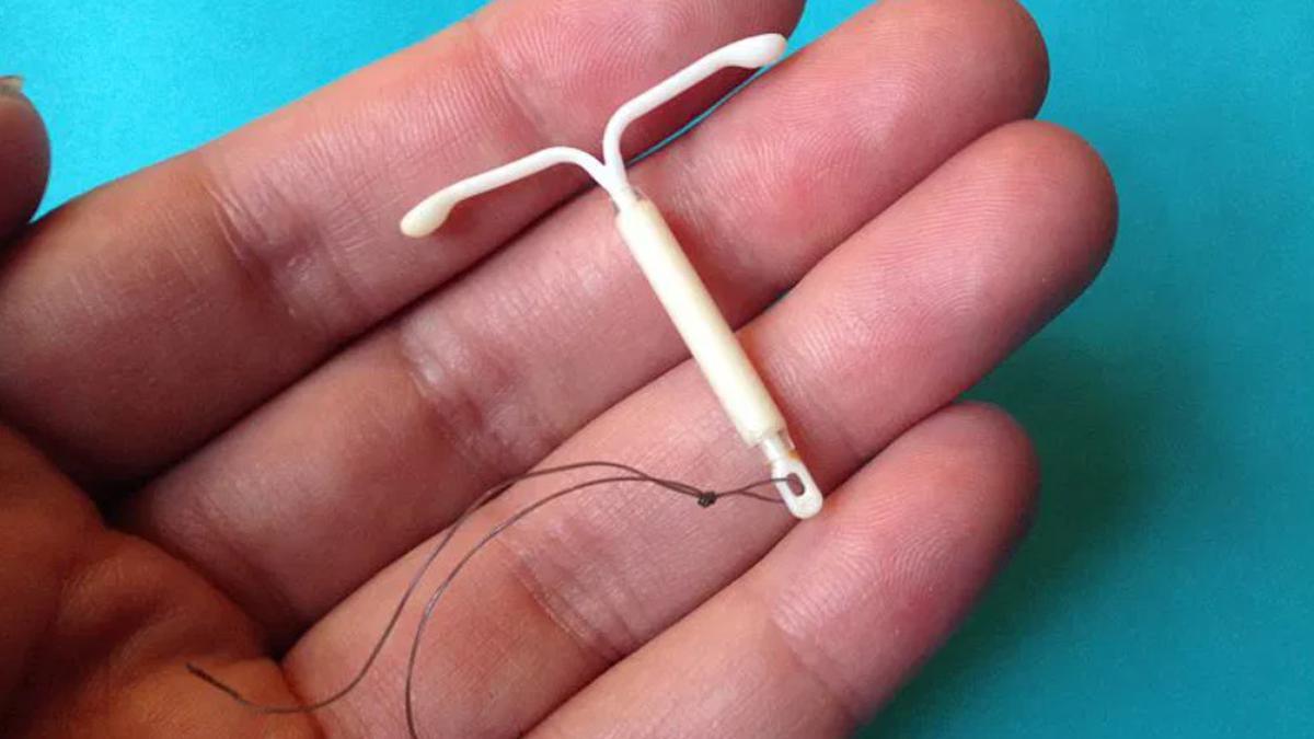 Cara Pemasangan KB IUD dan Fakta Penting yang Wajib Diketahui Pasien